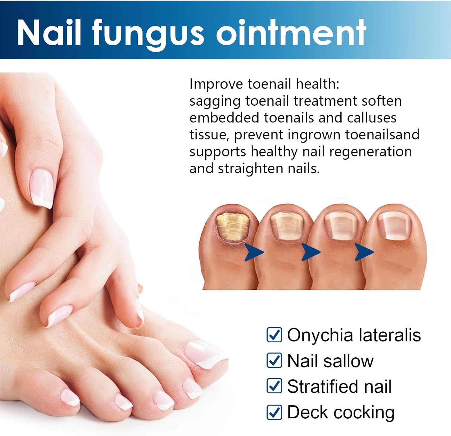 4 x Stylo Soin des Ongles, Réparateur d'Ongles, Soin des Ongles des Mains et des Pieds, Nourrissant et Apaisant pour les Ongles, Restaure l'Aspect Naturel de l'Ongle – Image 5