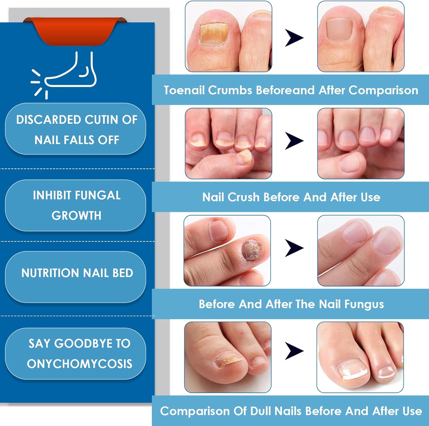 4 x Stylo Soin des Ongles, Réparateur d'Ongles, Soin des Ongles des Mains et des Pieds, Nourrissant et Apaisant pour les Ongles, Restaure l'Aspect Naturel de l'Ongle – Image 7