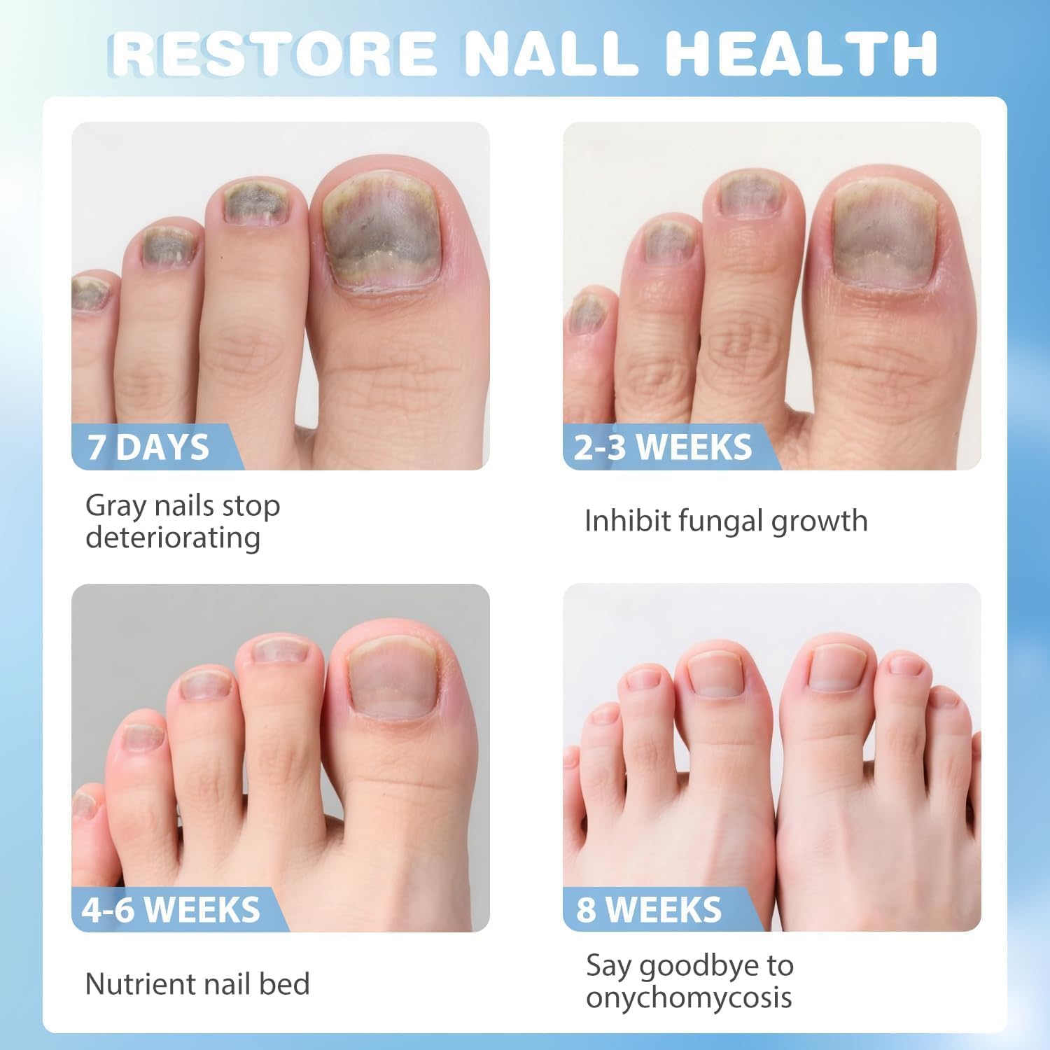 Soin intensif des ongles - Améliore l'apparence des ongles abîmés et décolorés - Formule active pour les ongles des pieds et des mains - Flacon de 20 ml avec applicateur – Image 3