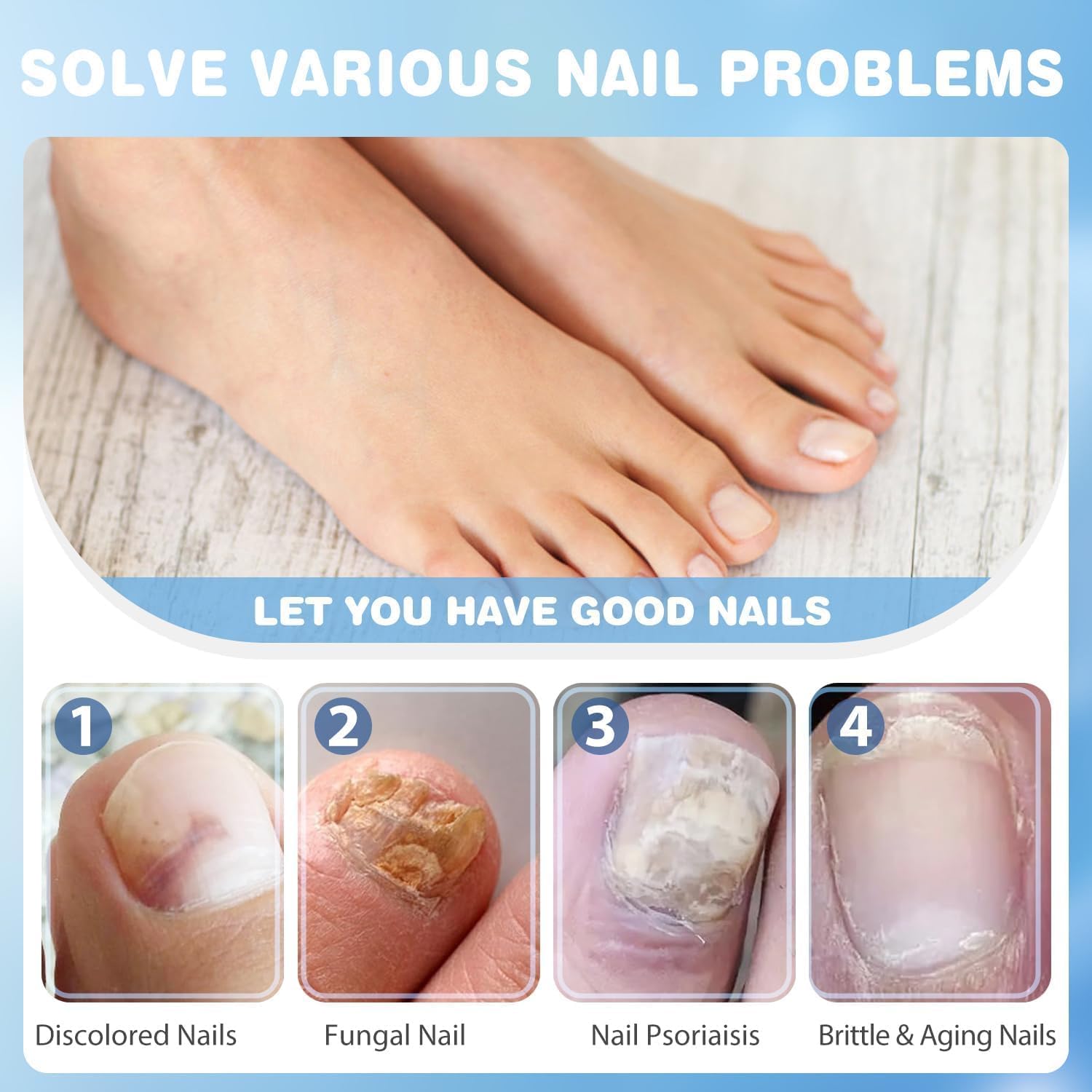 Soin intensif des ongles - Améliore l'apparence des ongles abîmés et décolorés - Formule active pour les ongles des pieds et des mains - Flacon de 20 ml avec applicateur – Image 4