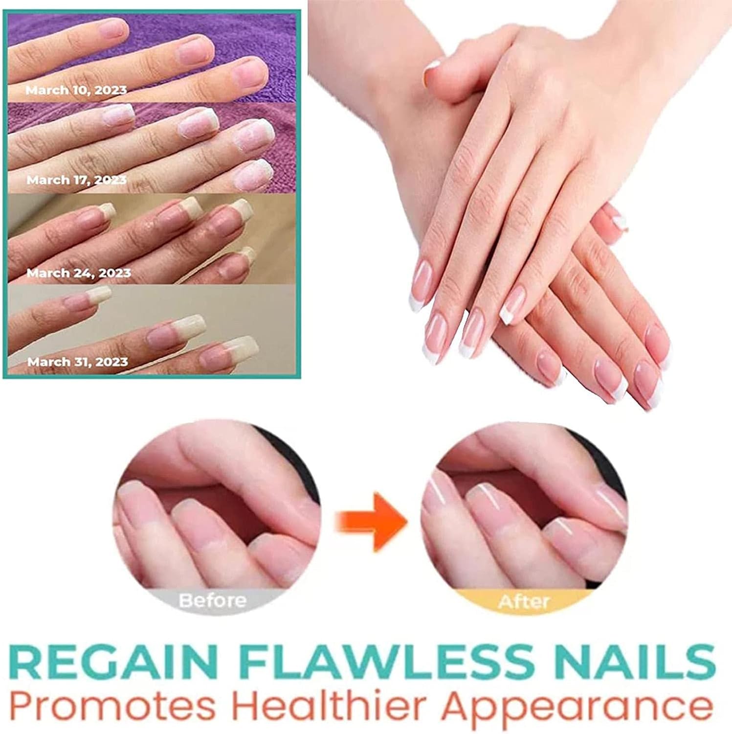 Renforce l'huile pour les ongles, 15 durcisseurs d'ongles professionnels pour les traitements des ongles, conception compte-gouttes pour une qualité de salon à la maison – Image 7