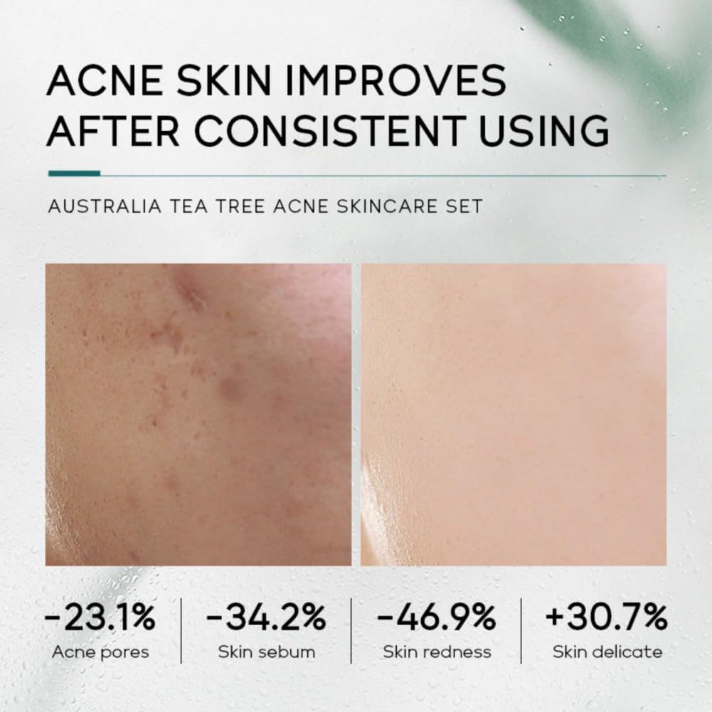 Ensemble complet de soins du visage, hydratant, nourrissant et contrôle du sébum, adapté à tous les types de peau, idéal pour offrir une beauté aux femmes avec un format mini voyage – Image 3