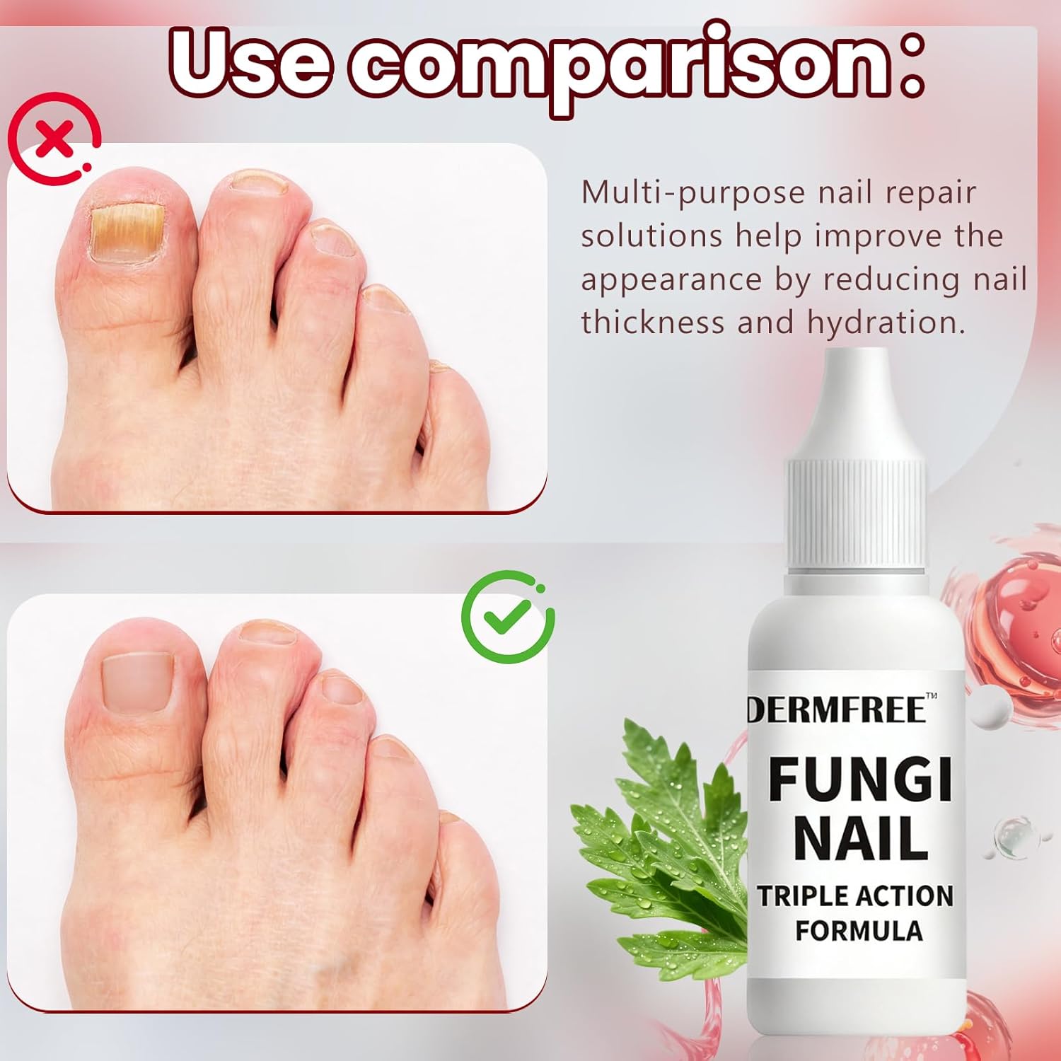 Solution pour ongles 15 ml, liquide de réparation des ongles, huiles de soin des ongles des pieds/mains, pour ongles cassants, pour hommes et femmes – Image 4