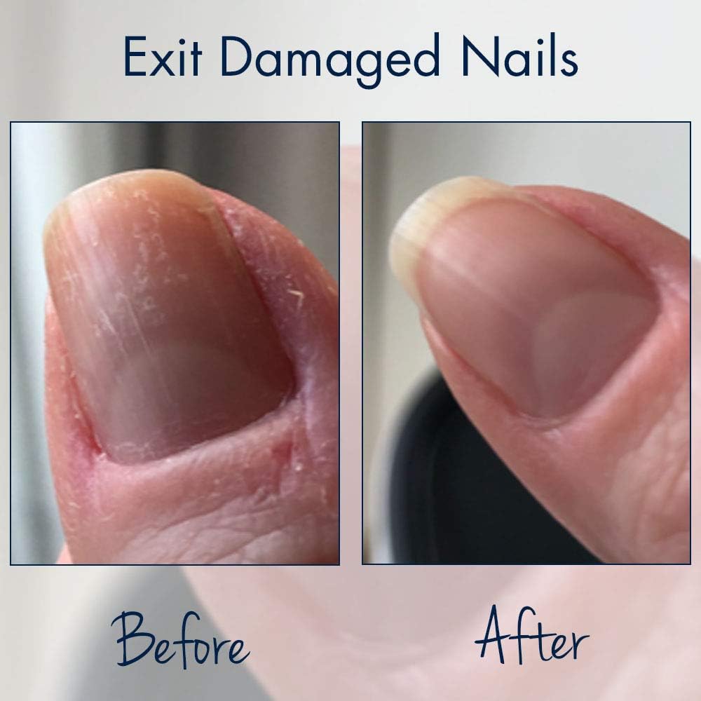 Herome SOS Nail Care Combi-Pack – Traitement réparateur pour ongles abîmés et cassants – Colle fortifiante et réparatrice – Résultats visibles en 30 jours – Image 7