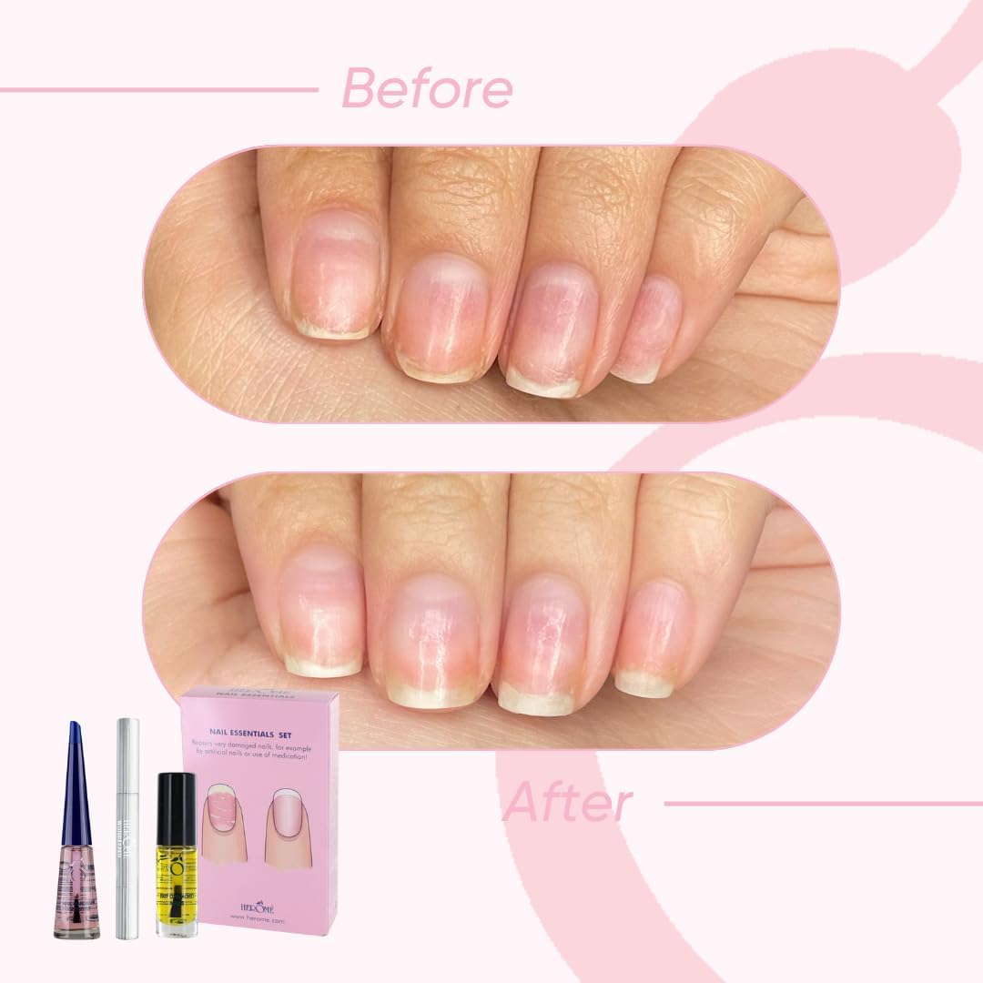 Herome Kit Nail Essentials 3 en 1 (Rose) – Kit de voyage – Soin réparateur pour ongles cassés après faux ongles, huile pour ongles abîmés, sérum pour cuticules et durcisseur – Image 3